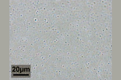 Milch sieht zwar von Auge einheitlich aus, unter dem Mikroskop zeigen sich jedoch viele Tröpfchen in einer Flüssigkeit. <p class="small mt-2">Bildquelle: <a href="https://commons.wikimedia.org/wiki/File:Milkccar.jpg" target="_blank">Wikipedia (modifiziert)</a></p>